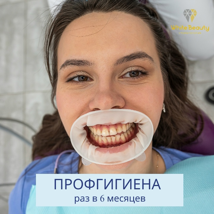 Профессиональная гигиена White Beauty